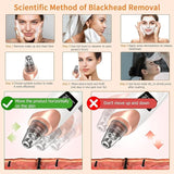 WAYANADAN Blackhead Remover “Comes with a Warranty”